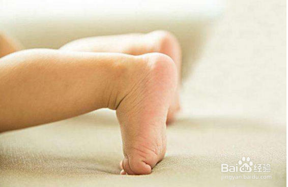 孩子有罗圈腿该怎么办？如何预防呢？