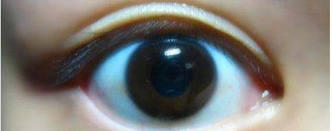 读心术——如何从眼睛(虹膜)读懂别人