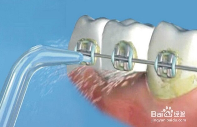 洗牙洁牙多长时间一次比较好