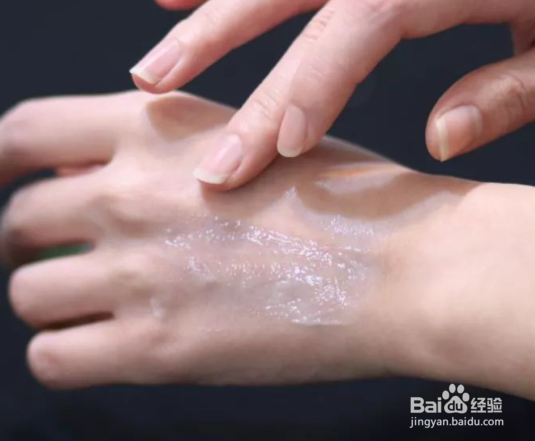 粘蝇纸粘到手上怎么办