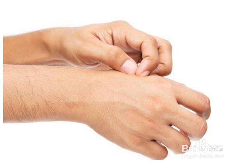 什么情况可以用伊之魅乳膏?