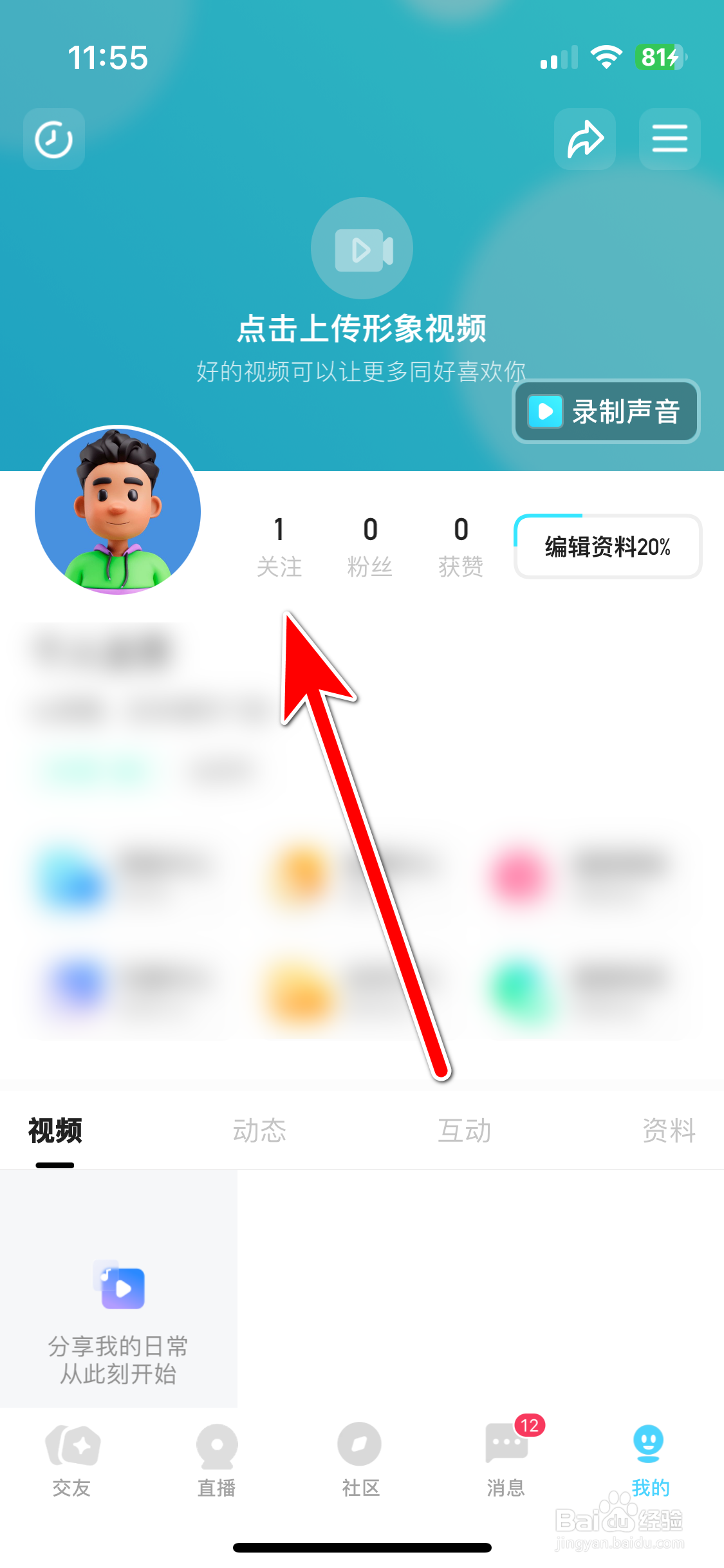 喜弟如何取消关注用户