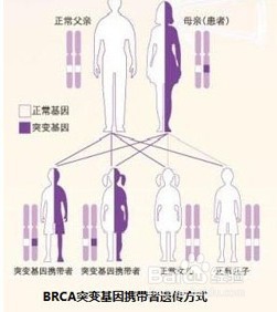 什么是乳腺癌