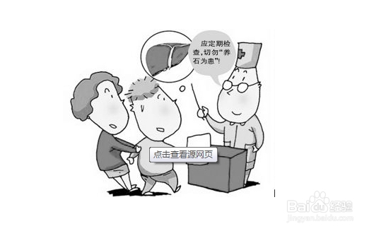 胆囊结石怎么办？