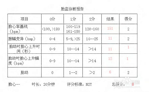 准妈妈需要注意的那些小事你需要知道下！