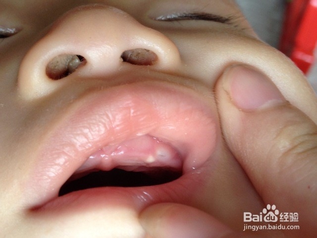 婴儿鼻屎清理方法