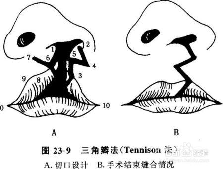女为知己者——整形还是美容