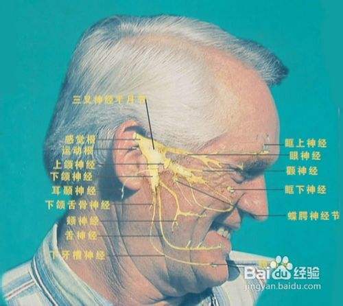 三叉神經痛的早期症狀怎麼判斷