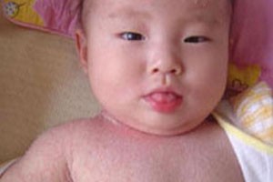 宝宝起痱子怎么预防