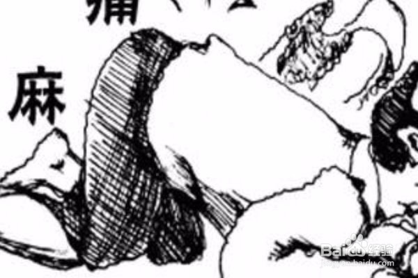 是什么导致腰椎间盘突出复发