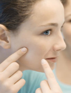 怎样消除雀斑痘印,四类护肤法让你白净一下