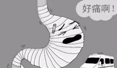 感染幽门螺旋杆菌HP,可以使用此方根治