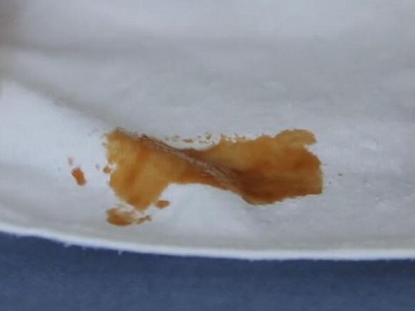 衣服上的油渍洗了第二遍还能干净吗