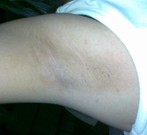 减少身体里（上）的细菌