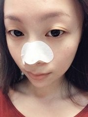 鼻子毛孔粗大有黑头怎么办?