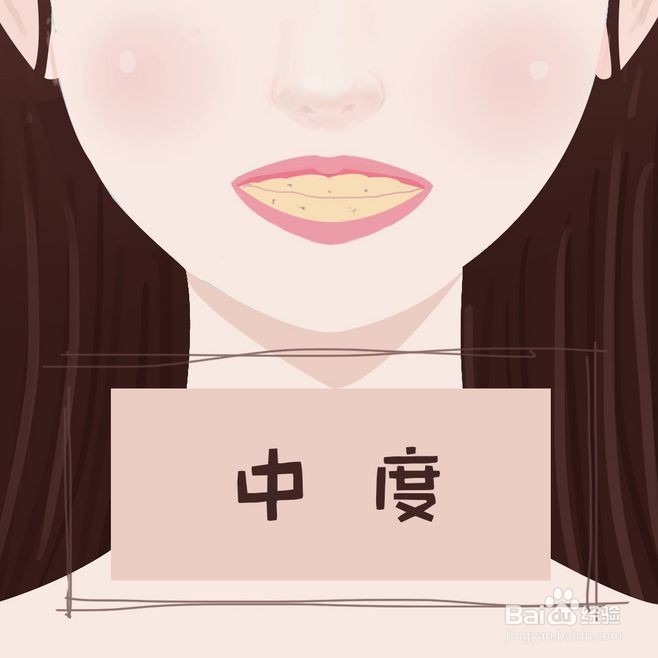 什么是氟牙症？有什么危害？