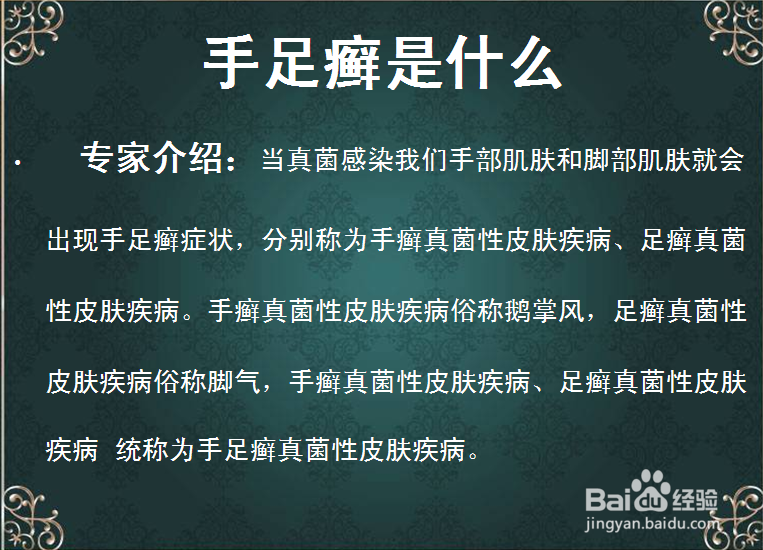 手足癣 手足癣怎么办