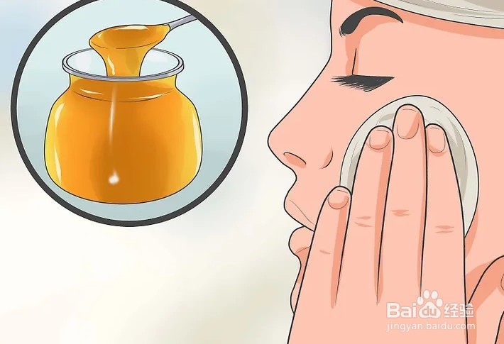 脸上长粉刺怎么办用什么方法消除