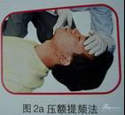 执业医师实践技能考试中的心肺复苏术如何操作