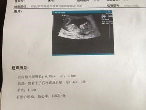 从怀孕到宝宝出生需要做的重要检查