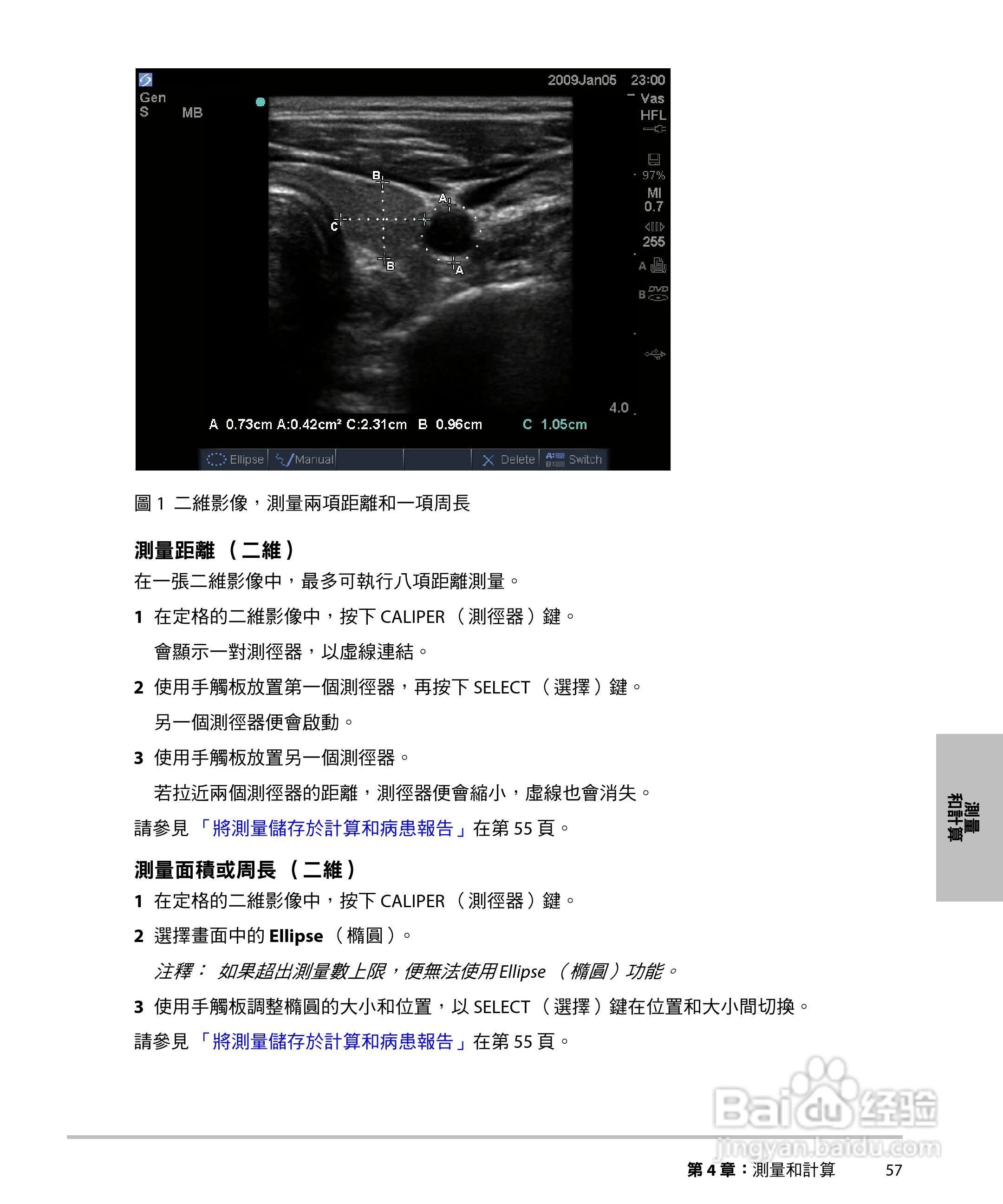SONOSITE M-TURBO超音波仪器使用手册:[7]
