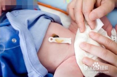 新生儿的家庭护理