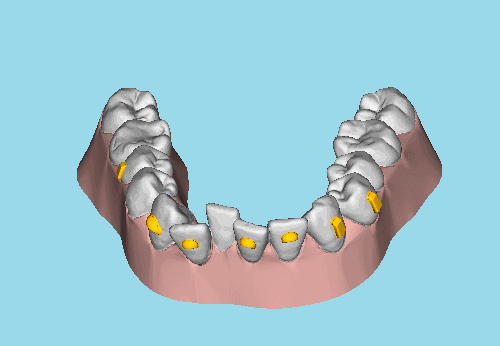 健康/养生 医疗健康 > 五官科 10 皮筋收缝   6～12个月左右,牙齿就