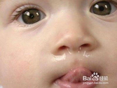 十个月宝宝咳嗽流鼻涕怎么办