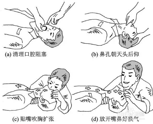 对于触电者应该怎样进行急救