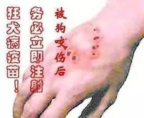 被狗咬了怎么办?