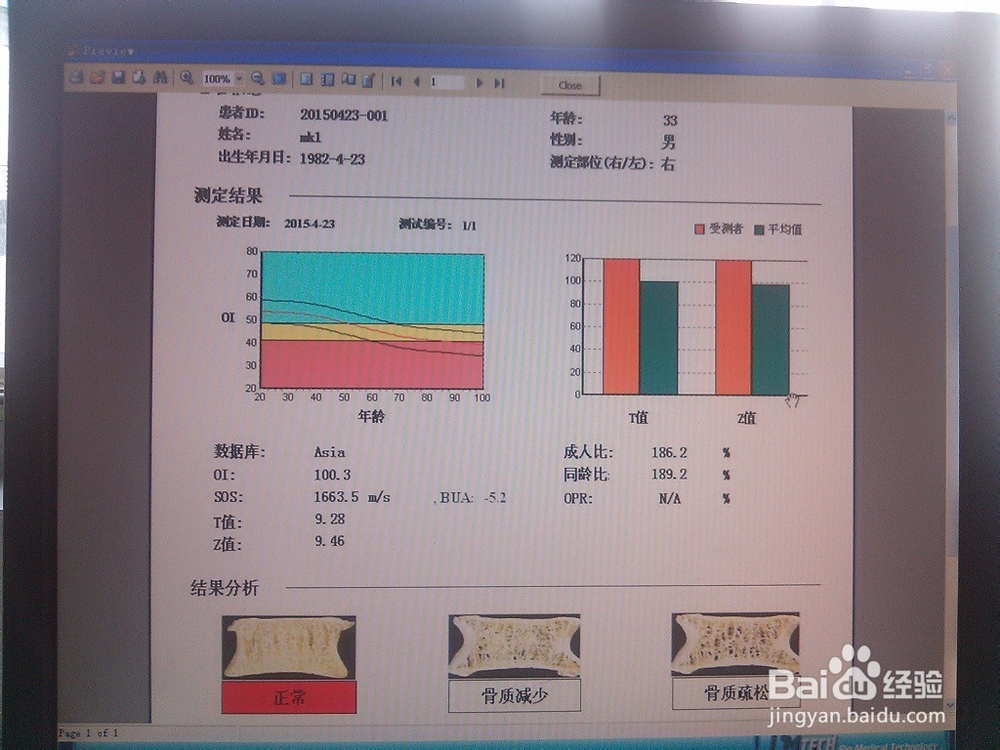 骨密度仪使用步骤