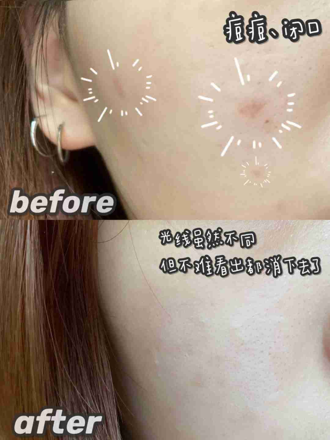 闭口水油不平衡？那是你没遇见它