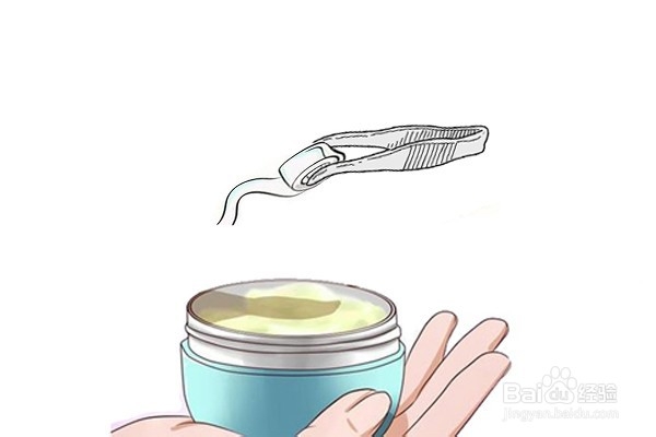 空腔型褥疮怎么治疗