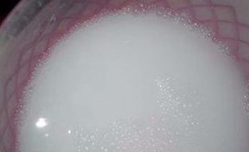 夏季生活常识避免蚊子的侵扰？