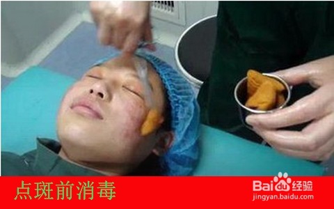 <b>用药水点斑后怎么护理/点斑水点斑后如何保养</b>