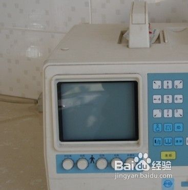 妇科B超检查前要做哪些准备