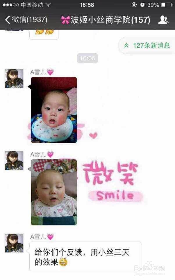 怎样快速修复过敏