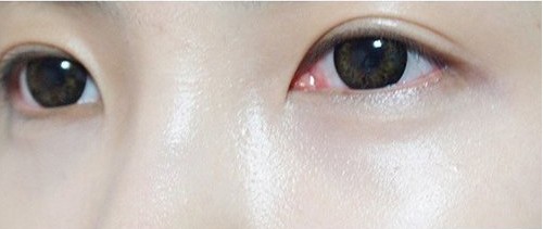 夏季怎样打造清纯少女妆