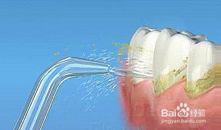 如何清洁牙齿