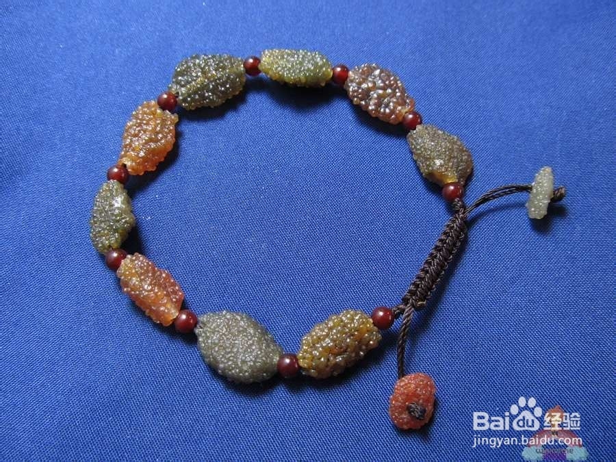 男人夜尿多会是前列腺炎吗？