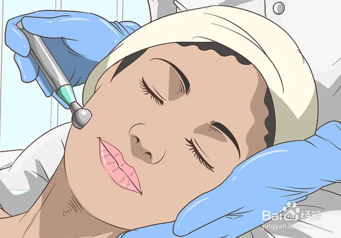 如何去除女性脸上的毛发