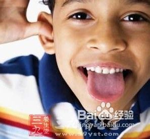 舌头 如果你是“光滑舌”就要注意了