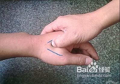 关键时刻救命的6大关键穴位