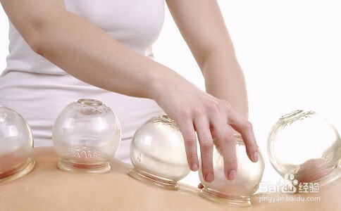 如何拔火罐以及注意事项