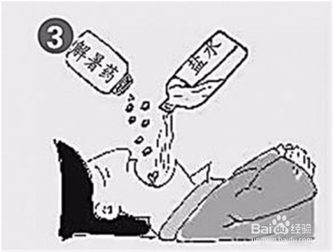 夏天中暑了怎么办