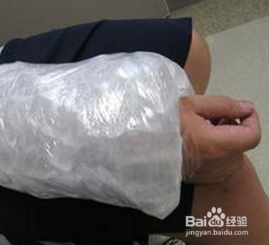 被蜂蜇了如何处理