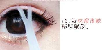 眼睛一单一双怎么办