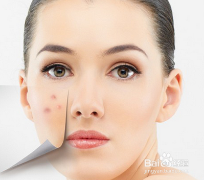 问题面部肌肤的护理