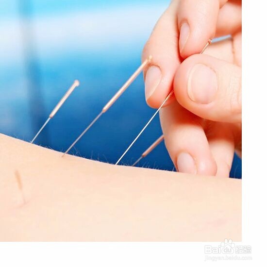 减肥需要注意的几个问题