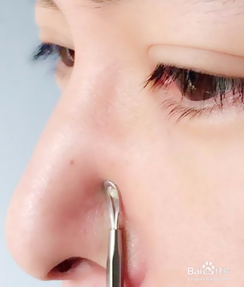 火山泥面膜泥可以祛痘去粉刺控油美白吗